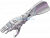 Upper Limb Prosthesis